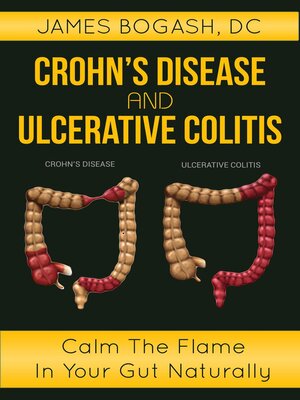 cover image of Crohn's Disease and Ulcerative Colitis
